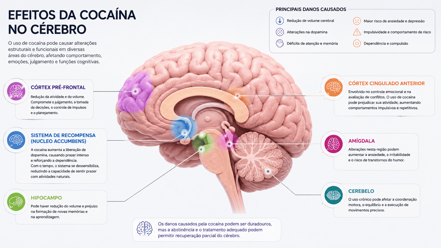 Ilustração dos efeitos da cocaína no cérebro humano